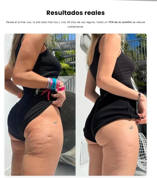 Ventosa Terapéutica Eléctrica: tecnología de spa, resultados desde casa.