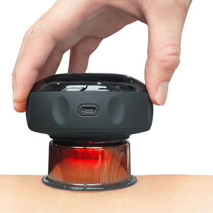 Ventosa Terapéutica Eléctrica: tecnología de spa, resultados desde casa.