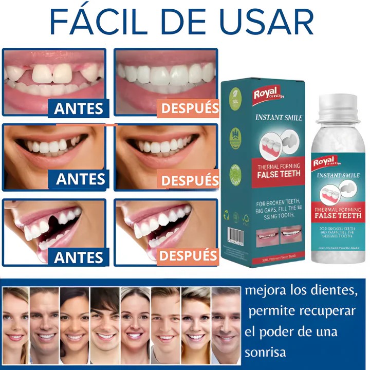 Dientes Postizos Temporales Reparación