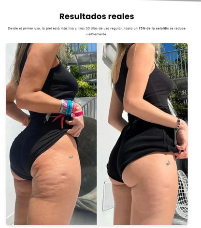 Ventosa Terapéutica Eléctrica: tecnología de spa, resultados desde casa.