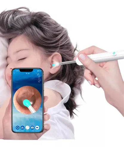 ¡Limpieza de oídos segura y eficaz!