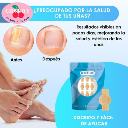 Dile adiós a los hongos y al mal olor – Pack de 16 parches efectivos