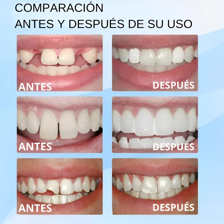 Dientes Postizos Temporales Reparación