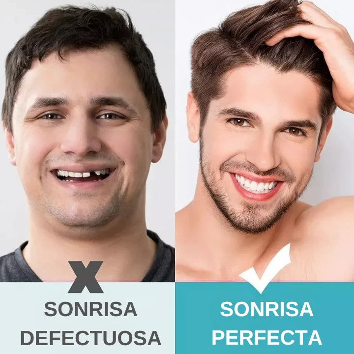 Dientes Postizos Temporales Reparación